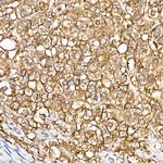 ZIP14 Polyclonal Antibody