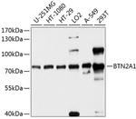BTN2A1 Antibody in Western Blot (WB)