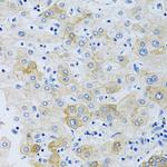SLC4A5 Polyclonal Antibody