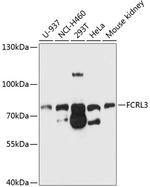 FCRL3 Polyclonal Antibody