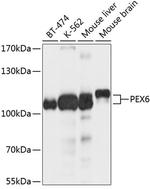 PEX6 Polyclonal Antibody