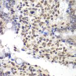 U2AF1 Antibody in Immunohistochemistry (Paraffin) (IHC (P))