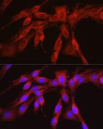 PHGDH Antibody in Immunocytochemistry (ICC/IF)