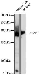ARAP1 Polyclonal Antibody