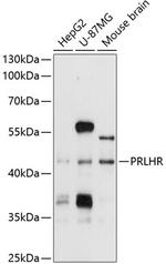 GPR10 Polyclonal Antibody