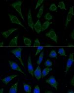 AKR1C2 Antibody in Immunocytochemistry (ICC/IF)