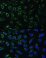 AKR1C2 Polyclonal Antibody