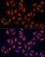 AGPS Antibody in Immunocytochemistry (ICC/IF)