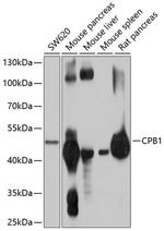 Carboxypeptidase B1 Polyclonal Antibody