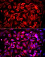 MTAP Antibody in Immunocytochemistry (ICC/IF)