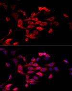 MTAP Antibody in Immunocytochemistry (ICC/IF)