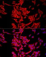 MTAP Antibody in Immunocytochemistry (ICC/IF)