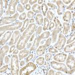 MTAP Antibody in Immunohistochemistry (Paraffin) (IHC (P))