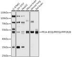 PPP2R2B Polyclonal Antibody