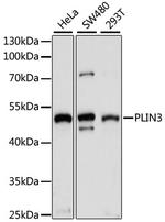 TIP47 Polyclonal Antibody
