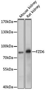 FZD6 Polyclonal Antibody