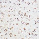NOMO1 Antibody in Immunohistochemistry (Paraffin) (IHC (P))