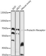 Prolactin Receptor Polyclonal Antibody