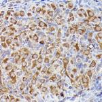 LGR5 Polyclonal Antibody