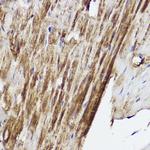 PLOD3 Polyclonal Antibody