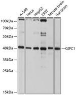 GIPC1 Polyclonal Antibody