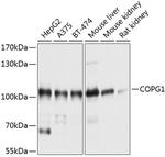 COPG Polyclonal Antibody