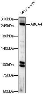 ABCA4 Polyclonal Antibody