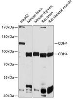 CDH4 Polyclonal Antibody