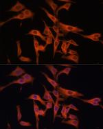 LGMN Antibody in Immunocytochemistry (ICC/IF)