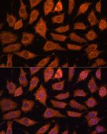 LGMN Polyclonal Antibody