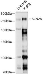 SCN2A Polyclonal Antibody