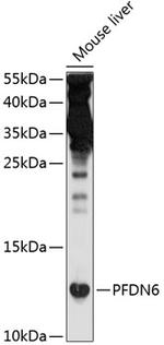 PFDN6 Antibody in Western Blot (WB)