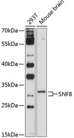 EAP30 Polyclonal Antibody