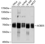 ACBD5 Polyclonal Antibody