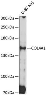 COL4A1 Antibody in Western Blot (WB)