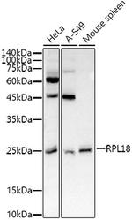 RPL18 Polyclonal Antibody