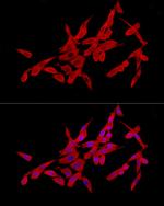 SLC27A2 Antibody in Immunocytochemistry (ICC/IF)