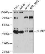 NUPL2 Polyclonal Antibody