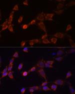 PSMD14 Polyclonal Antibody