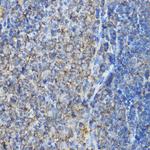 ARPC2 Polyclonal Antibody