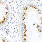 FAM3B Antibody in Immunohistochemistry (Paraffin) (IHC (P))