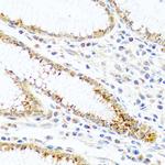 FAM3B Antibody in Immunohistochemistry (Paraffin) (IHC (P))