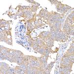 MAGED1 Polyclonal Antibody
