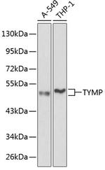 Thymidine Phosphorylase Polyclonal Antibody