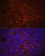 IL-1 beta Antibody in Immunohistochemistry (Paraffin) (IHC (P))