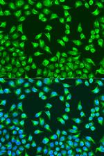 MTCO2 Antibody in Immunocytochemistry (ICC/IF)