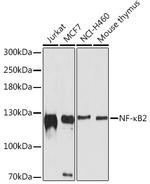 NFkB P100 Antibody in Western Blot (WB)
