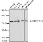 NGF Receptor Polyclonal Antibody