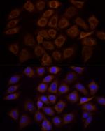 PI3K p85 alpha Polyclonal Antibody