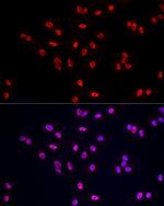 POLR2A Antibody in Immunocytochemistry (ICC/IF)